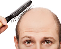 Випадіння волосся